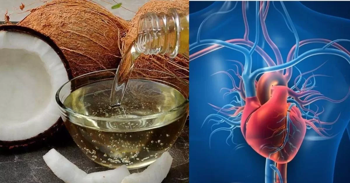 ಅಡುಗೆಗೆ ತೆಂಗಿನ ಎಣ್ಣೆ ಬಳಸುವುದು ಹಾನಿಕರ?