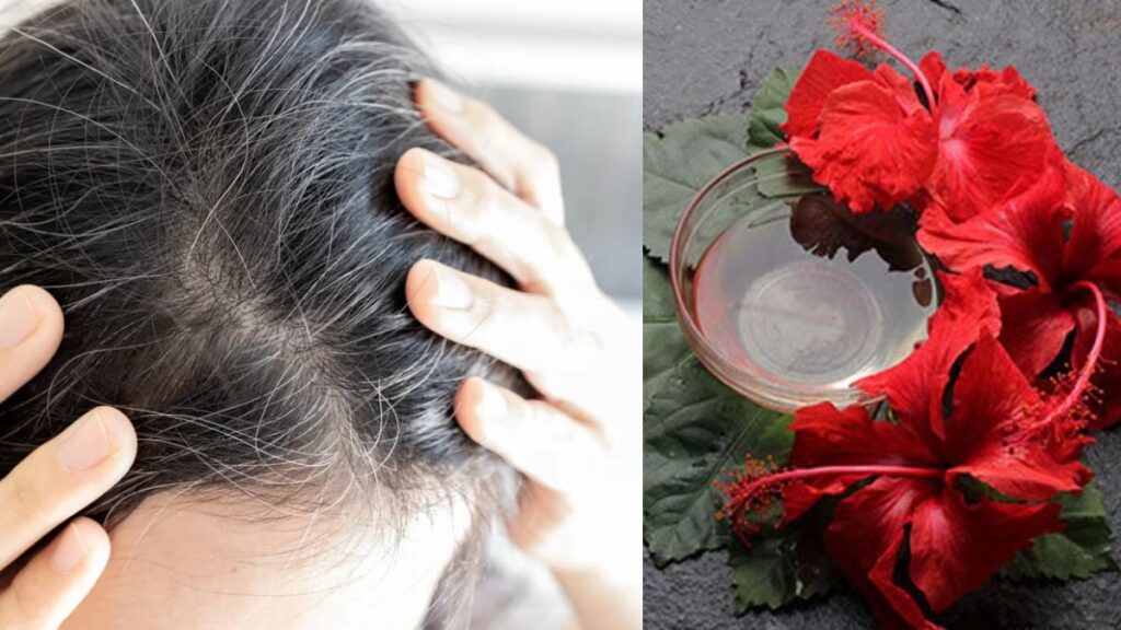 Home remedy for white hair kannada